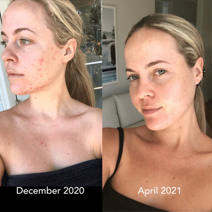 Glow & Lift – Premium USB Face Massager for Radiant, Toned Skin